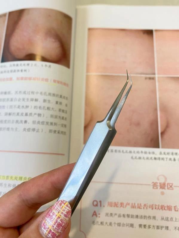 大娘去黑头大法真的有效吗 (大娘祛黑头之前要洗了没)