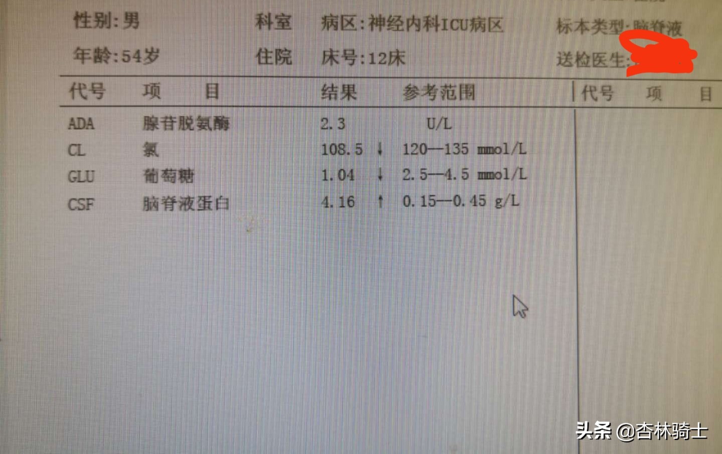 突然倒地抽搐中医怎么救治,我老公突然差点晕倒是怎么了