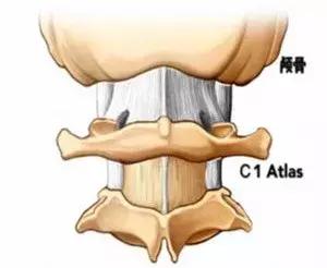颈椎病三招搞定,几招搞定颈椎病