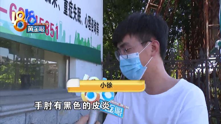 鑲樼毊鐐庢墦浜嗗嚑閽堝悗婧冪儌,鎵嬭倶鐨値娌荤枟