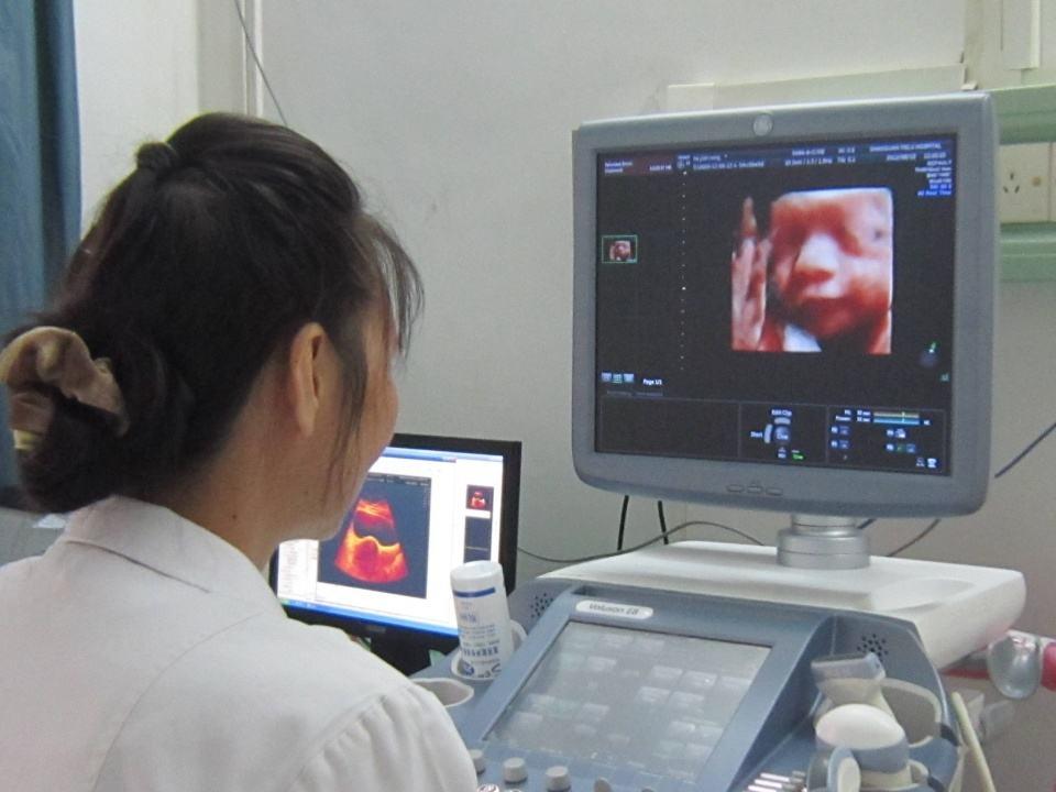 孕妇套话医生问男女,被识破臊一脸,这7项看男女的说法有效吗?