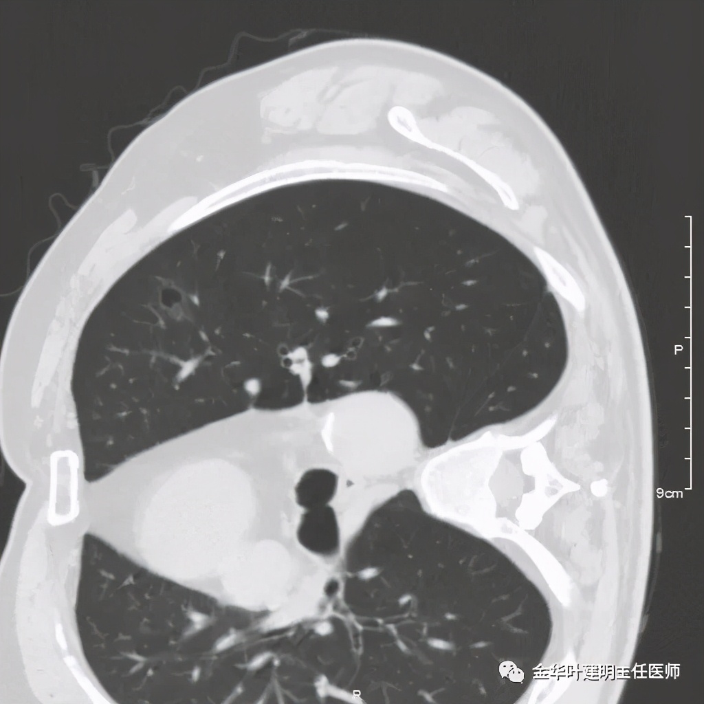 放个大招完整版教学,放个大招完整版前奏