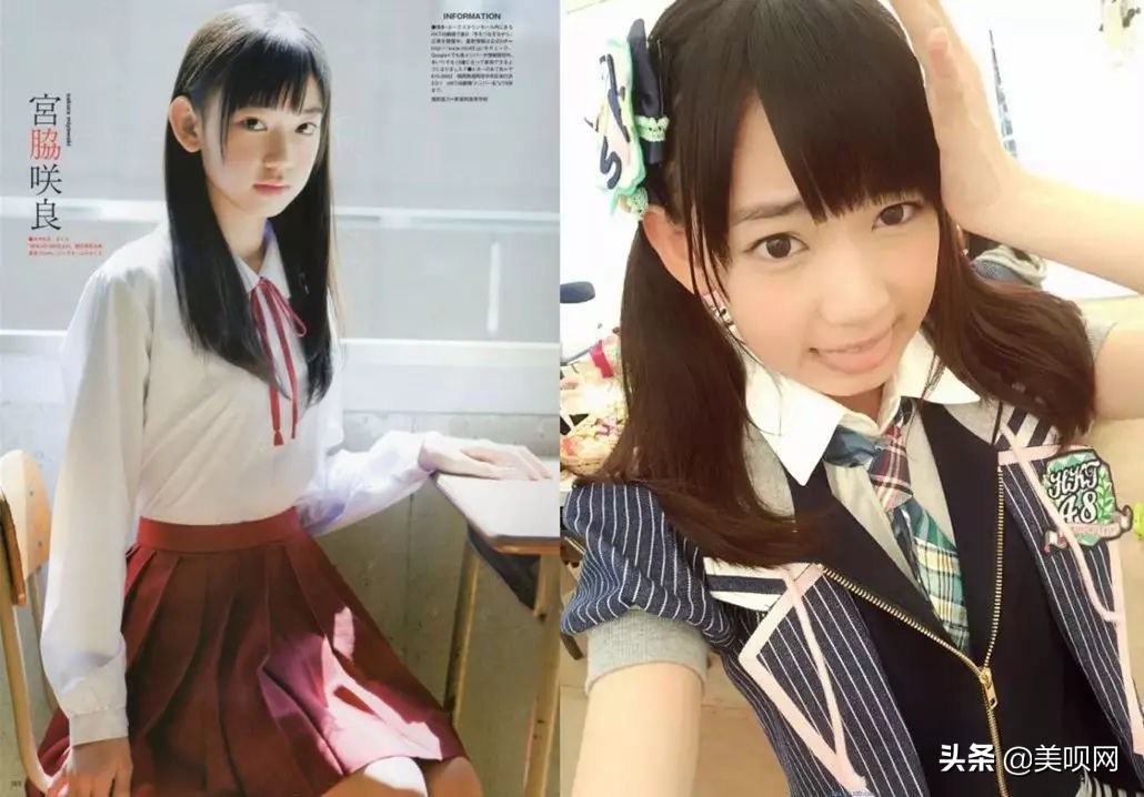 明星都在用的缩小鼻翼神器,明星鼻子做鼻翼缩小外切