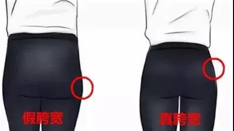 大腿外侧凸起怎么穿搭,大腿内侧两块赘肉穿裤子很难看