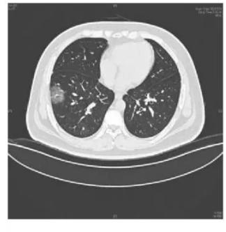 磨玻璃阴影怎么处理,磨玻璃阴影