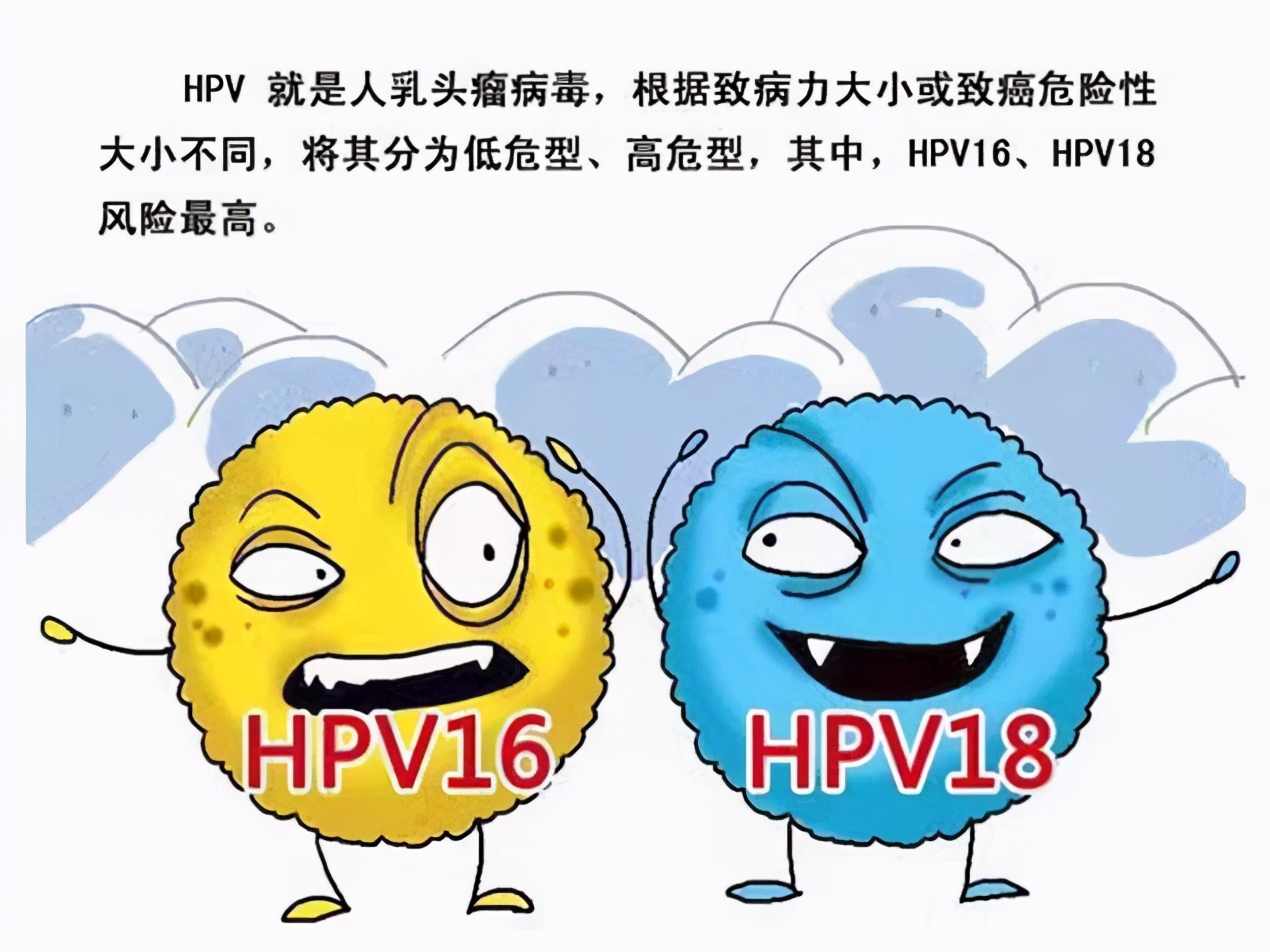 hpv16阳性是什么意思,hpv16阳性是什么意思tct重度炎症