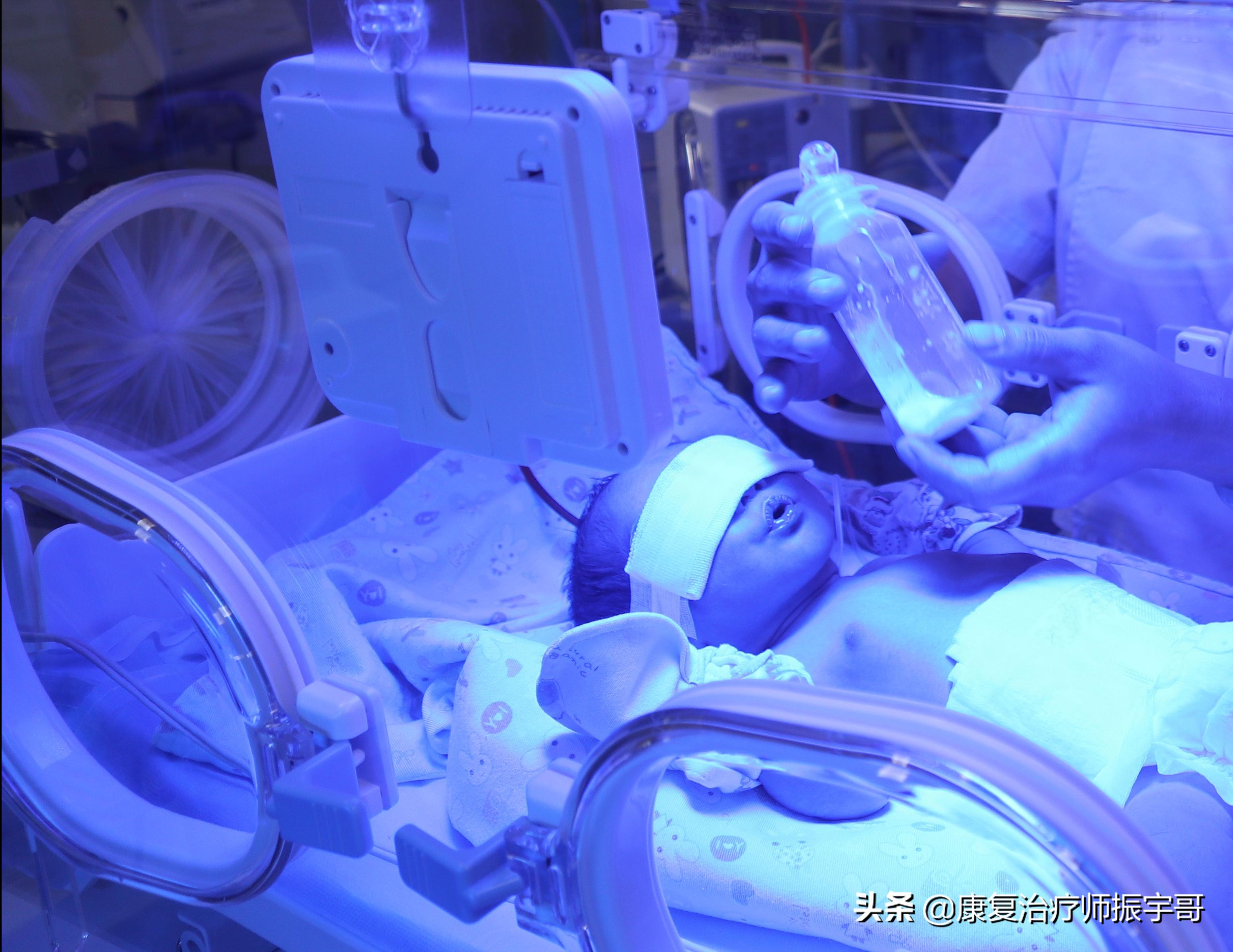 科普脑瘫患儿的家庭康复训练方法,能力很低的脑瘫儿如何做康复