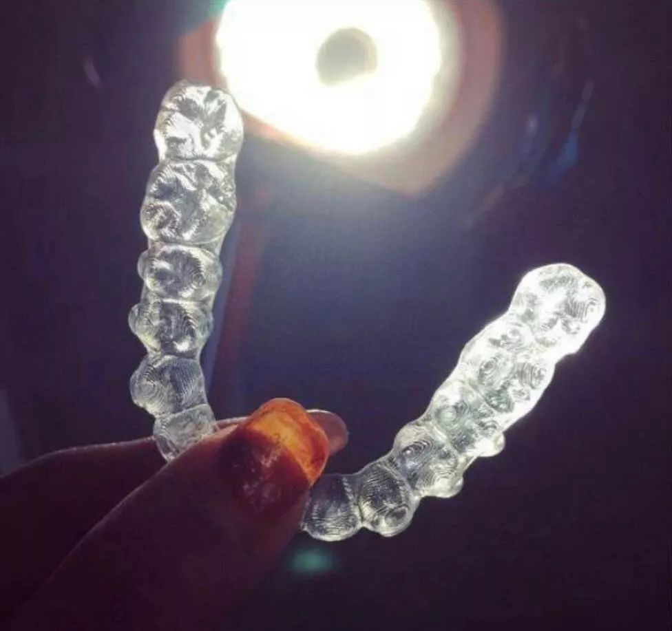 龅牙矫正前后对比照片,龅牙修复效果图