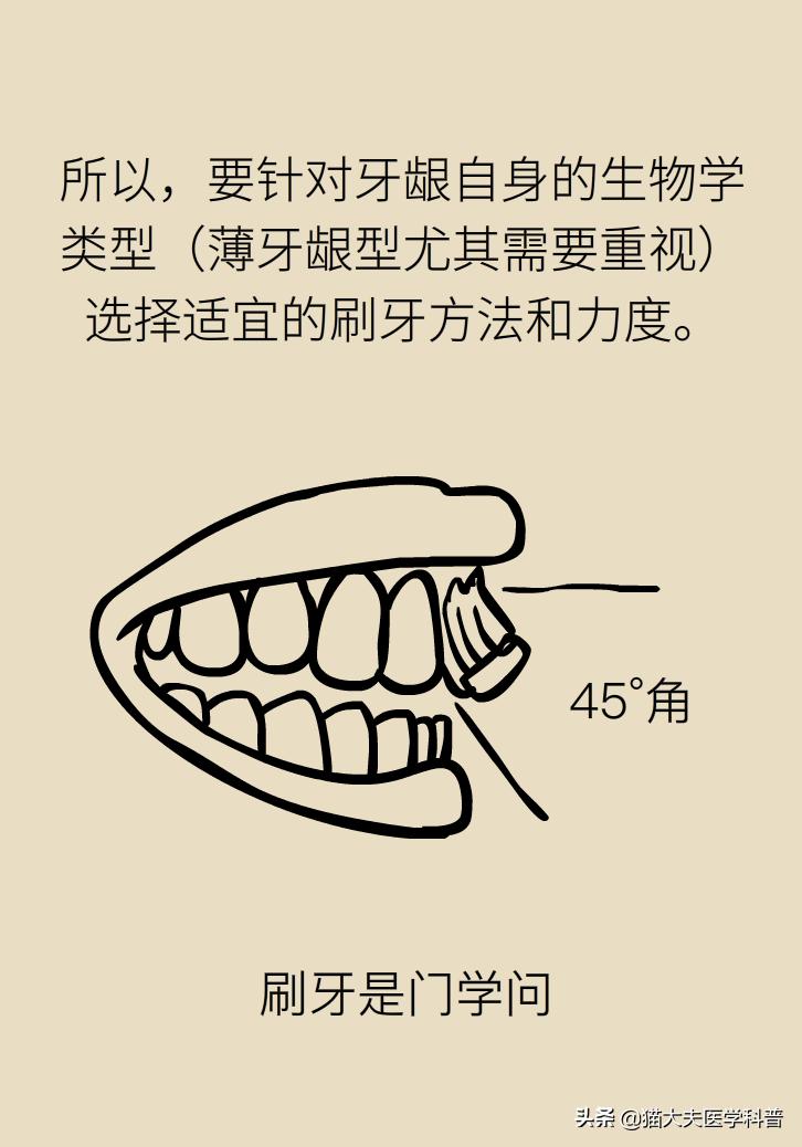 牙根暴露了该怎么刷牙,牙根治疗后可以刷牙吗