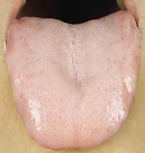 血虚体质有什么表现,血虚体质有哪些表现