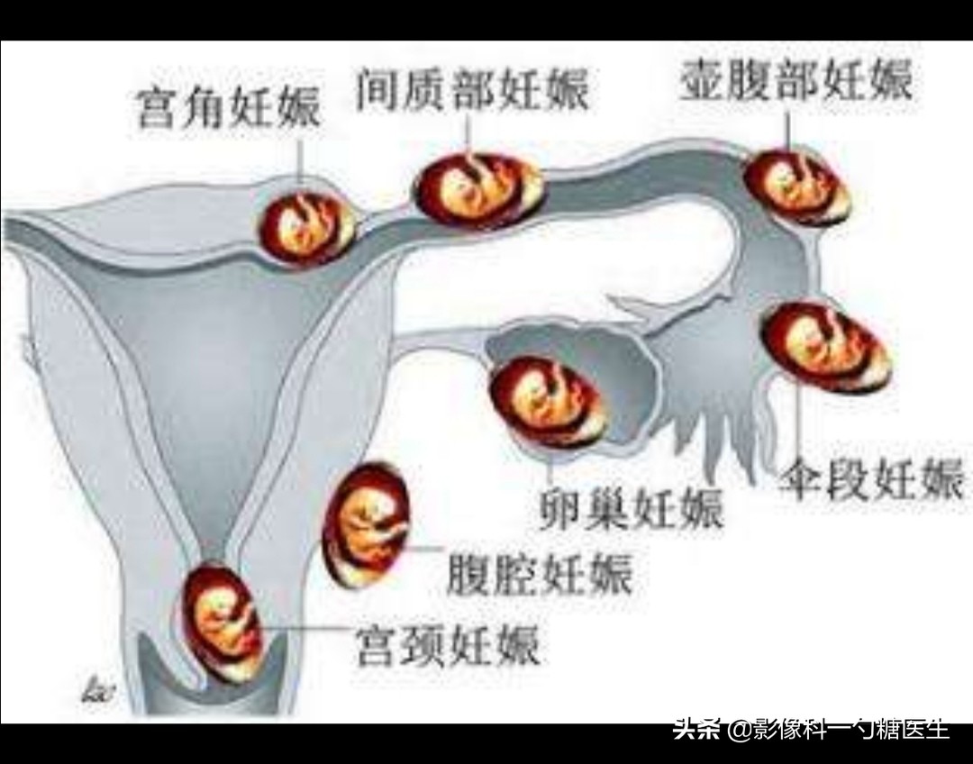 从14岁到17岁,从14岁到22岁