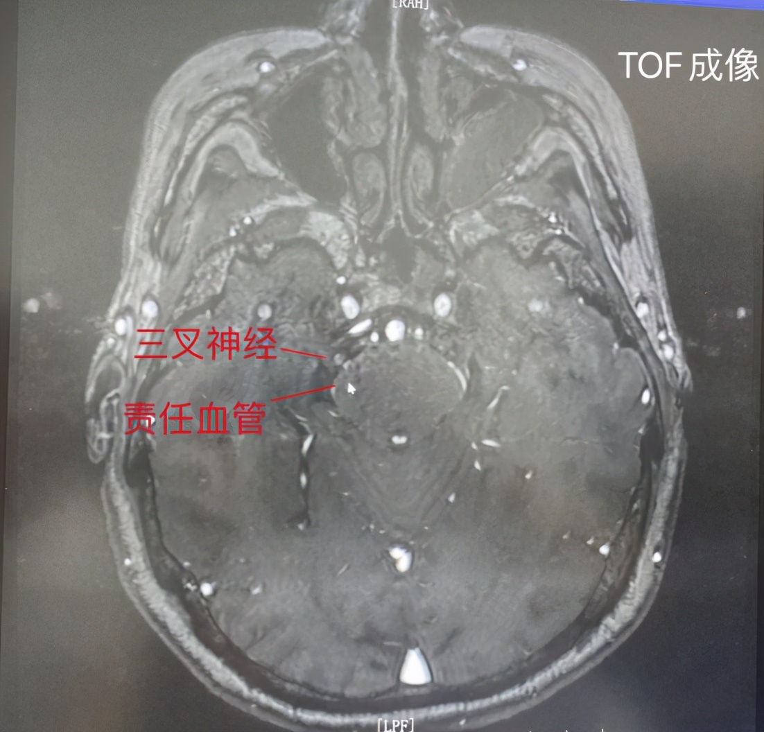 合肥华安脑科康复医院,合肥华安脑科医院