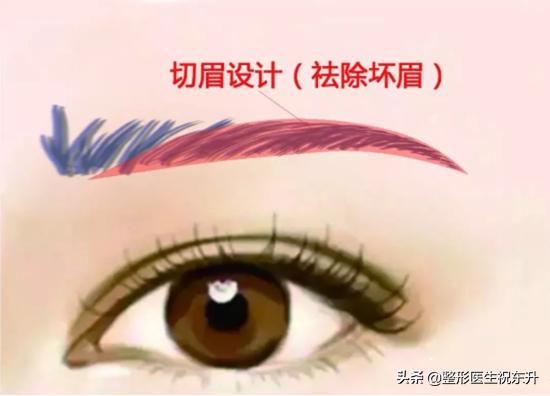 妈妈想做眉毛,哪些人群适合做提眉