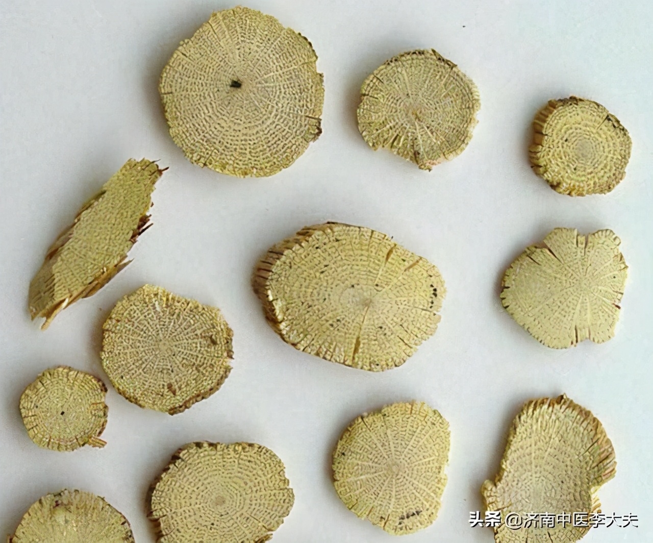 膀胱湿热会导致小便泡沫吗,膀胱湿热会导致什么