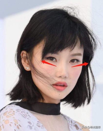 割双眼皮一定好看吗,割双眼皮真的好看吗