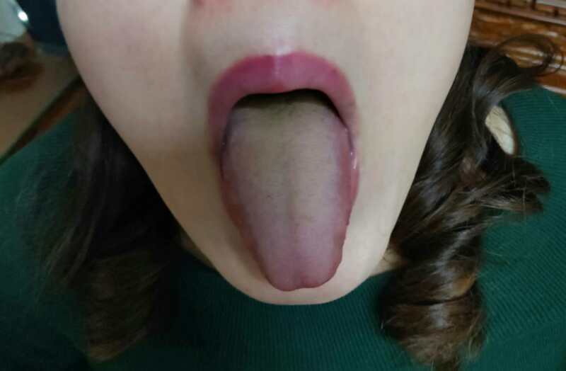 肾虚和湿气有关系吗,肾虚与湿热有关系吗