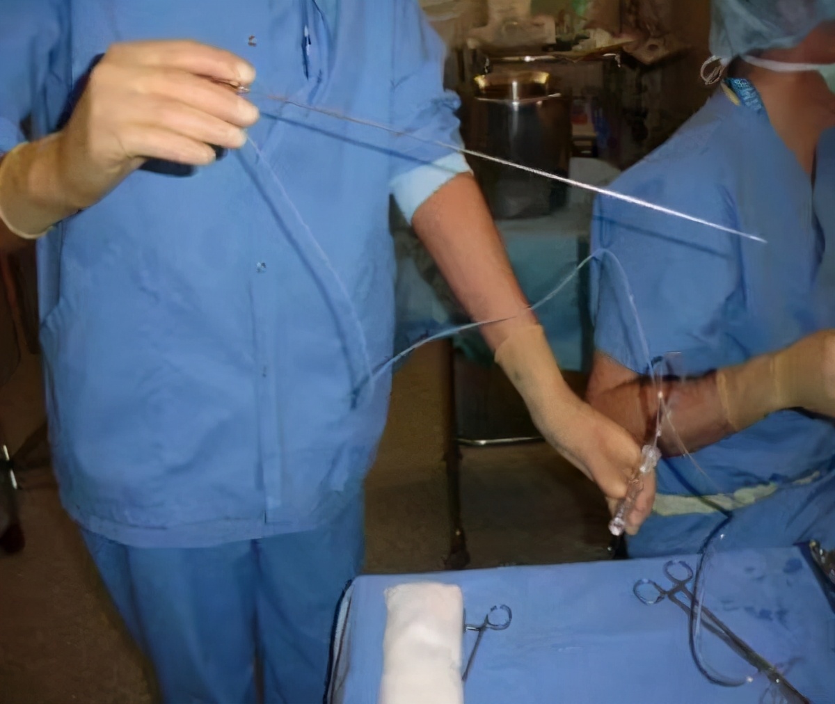 取女方卵子的针,取女性卵子过程痛苦吗