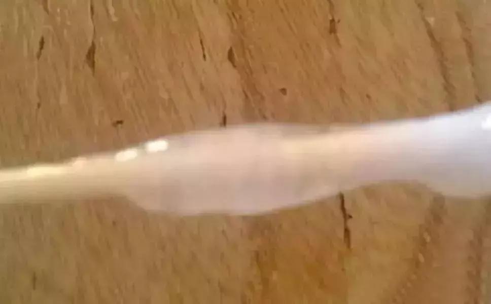 内裤的分泌物什么样是正常,短裤上有黄色的分泌物怎么办