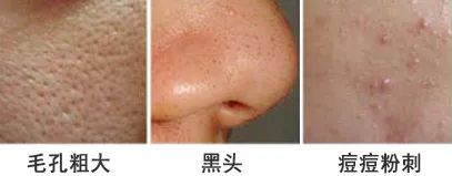 春雨蜂蜜面膜真实测评,春雨蜂蜜面膜用法及功效