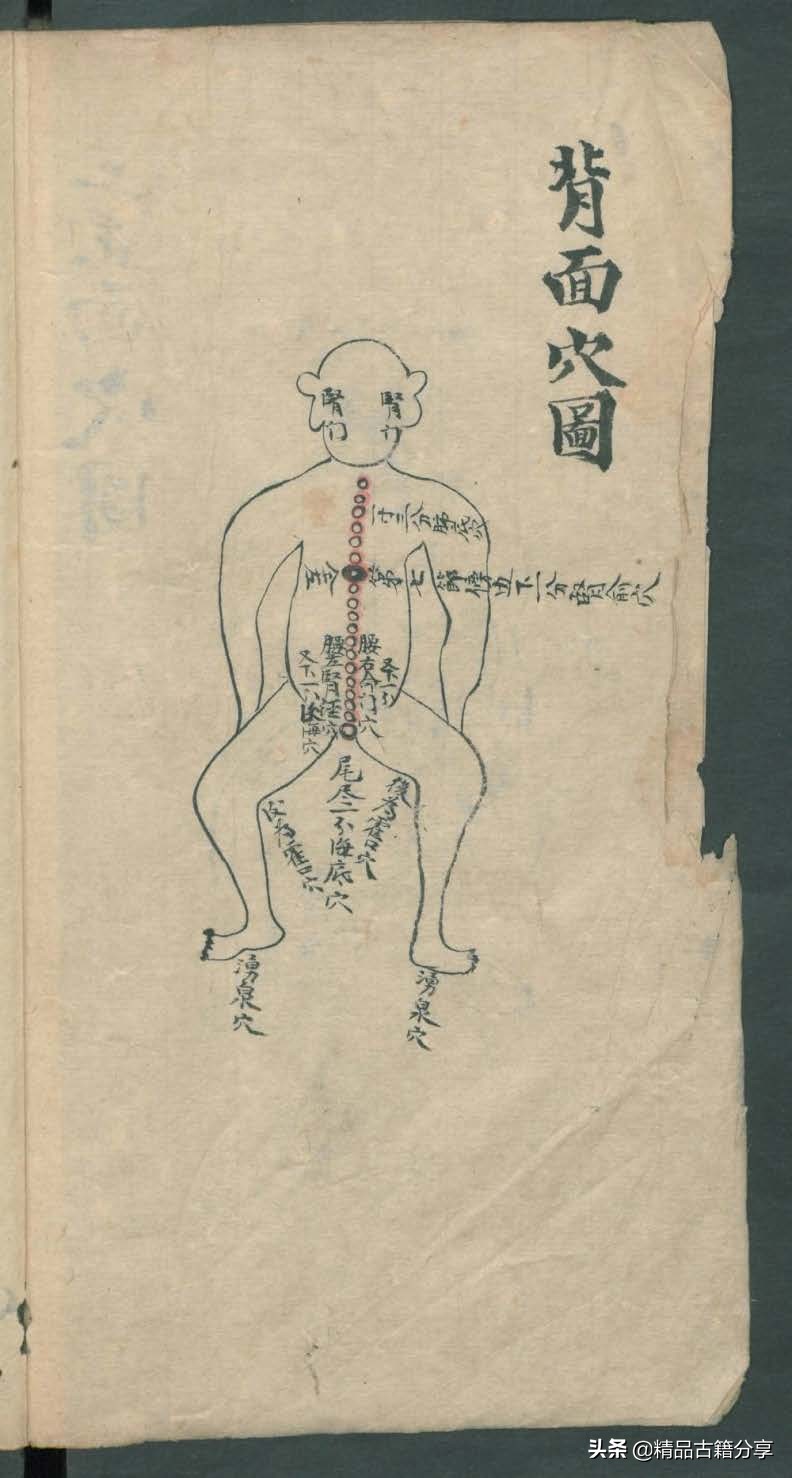 中医类抄本跌打损伤方面的医书欢迎阅读