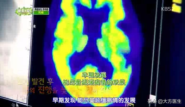 10个简单的手指动作预防老年痴呆,预防老年痴呆应从什么做起