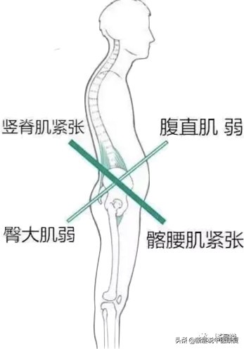 怎么缓解腰引起的臀部疼痛,怎样治疗腰痛和臀部肌肉疼痛