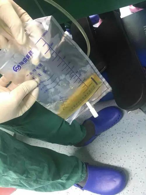 护士观察瞳孔注意事项,胸腔闭式引流的护理及注意事项