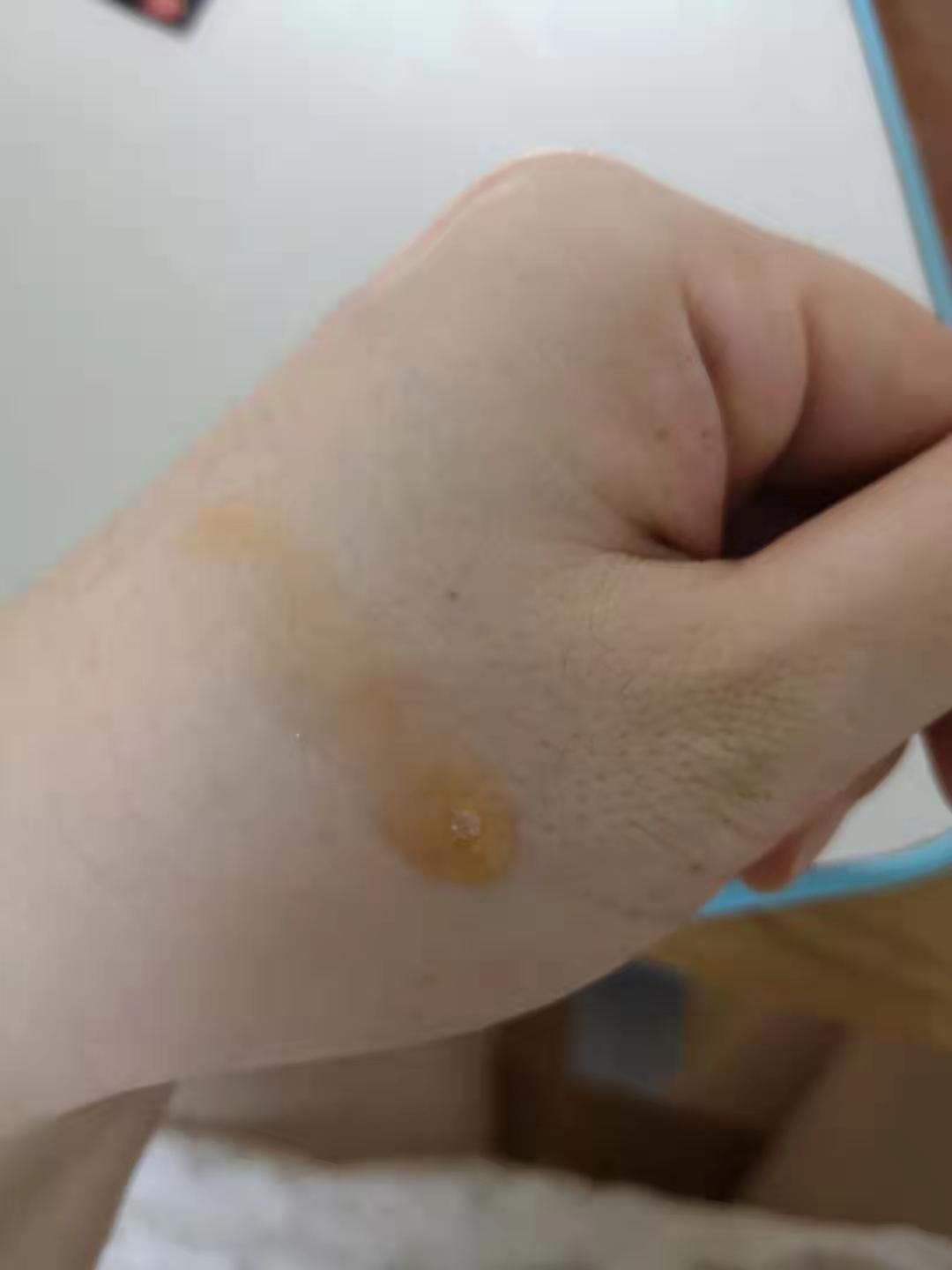 干皮护肤品推荐种草,干皮护肤种草