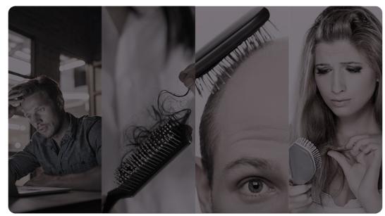 严重的掉头发，我该如何解决脱发问题？