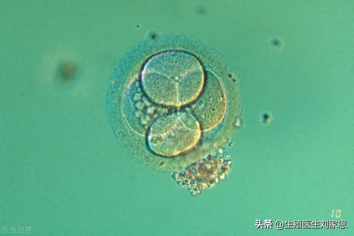 怀不上孩子才试管吗,怀不上孩子是男方还是女方先查