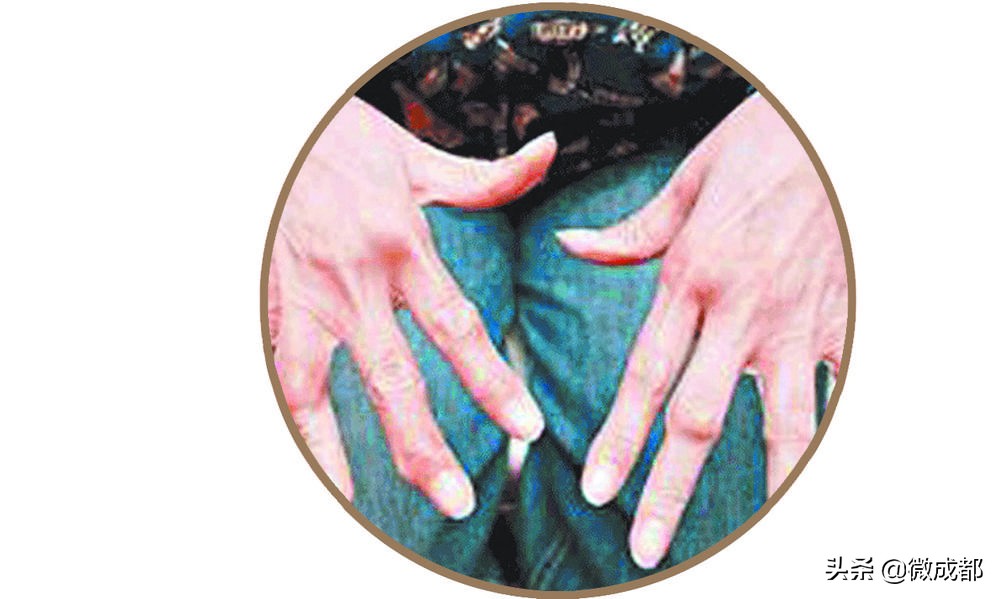 风湿关节病厉害了会怎样,风湿关节炎从轻到严重发病要几年