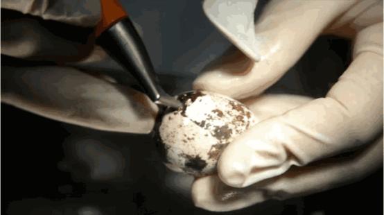 洗牙牙齿问题,医院口腔科洗牙和外面洗牙区别