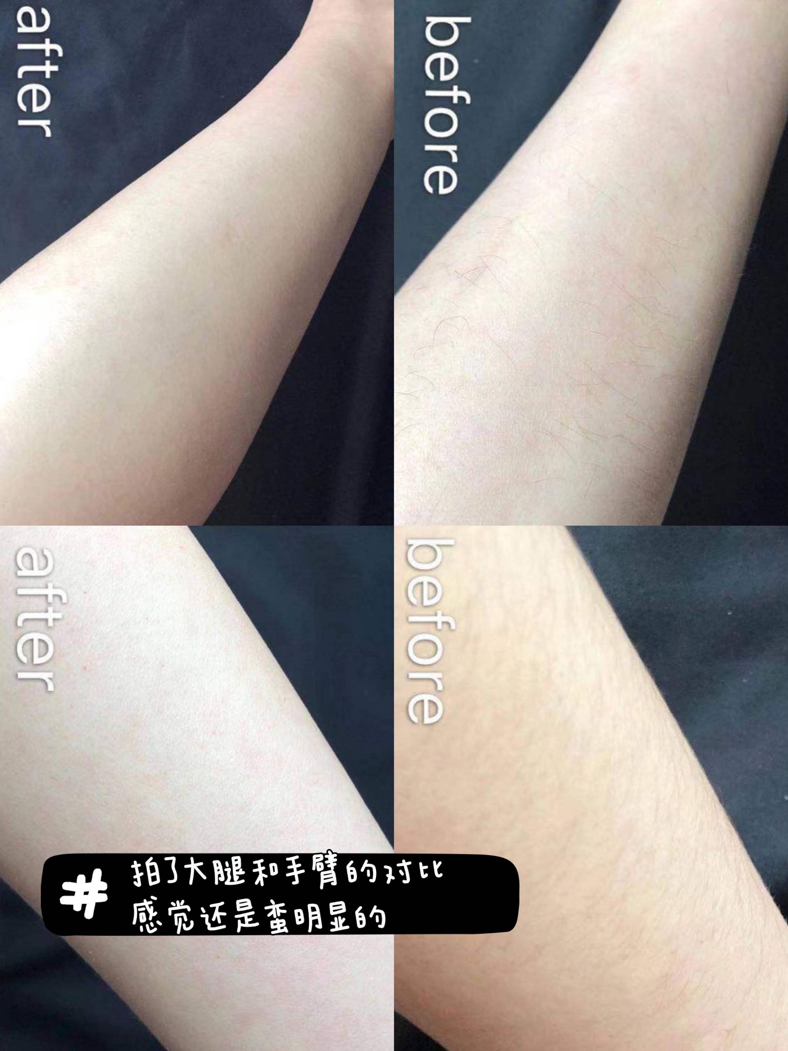 nextbeauty脱毛仪无法开机,nextbeauty脱毛仪危害