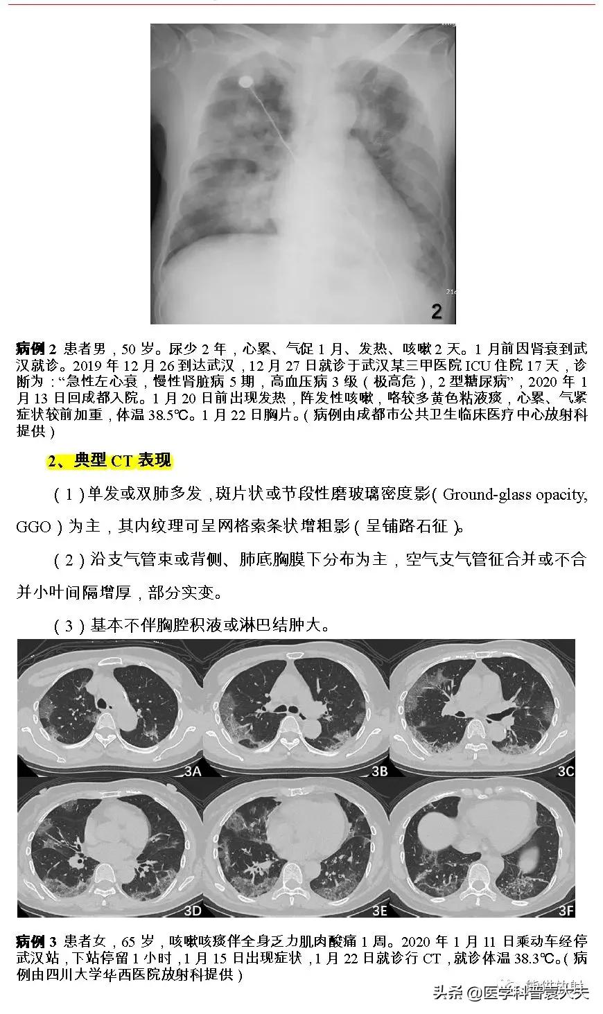 最新新型冠状病毒肺炎的指南,最新新型冠状病毒肺炎防控指南