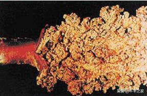 牛瘤胃疾病的最新治疗方法,牛瘤的症状有哪些