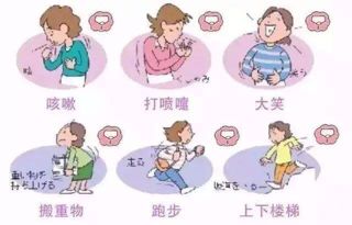 女性的子宫脱垂怎么治疗好,女性平常要怎么注意子宫脱垂