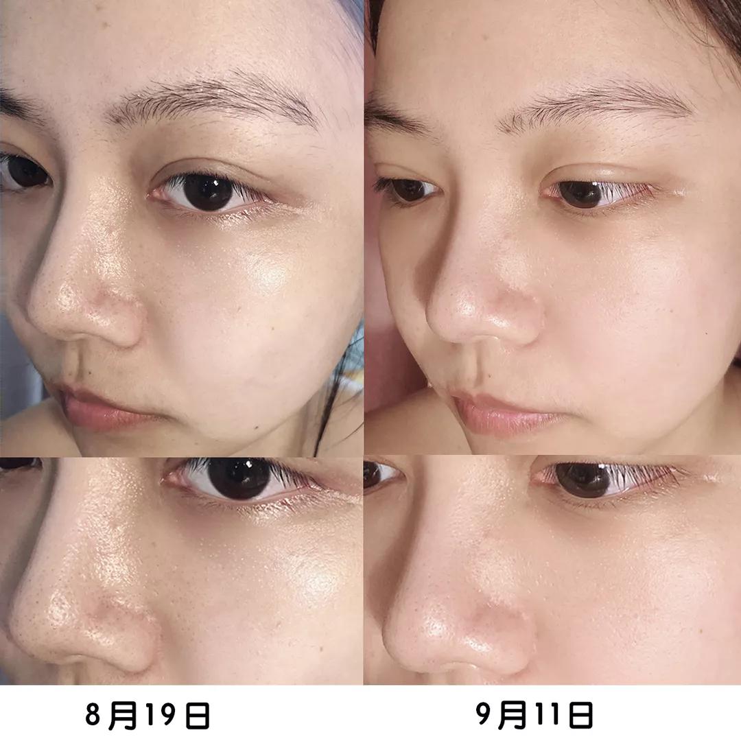 我的21天美容之路,我的养肤秘籍