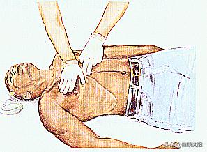 心肺复苏术真的能救命吗考试答案,健康科普知识心肺复苏急救手册