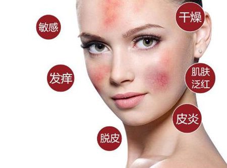 脸干燥脱皮怎么保湿护肤,脸部很干燥脱皮紧绷怎么办