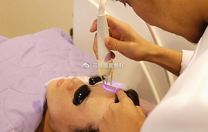 医美祛痘治疗有几种？怎么选择？超全科普告别痘肌