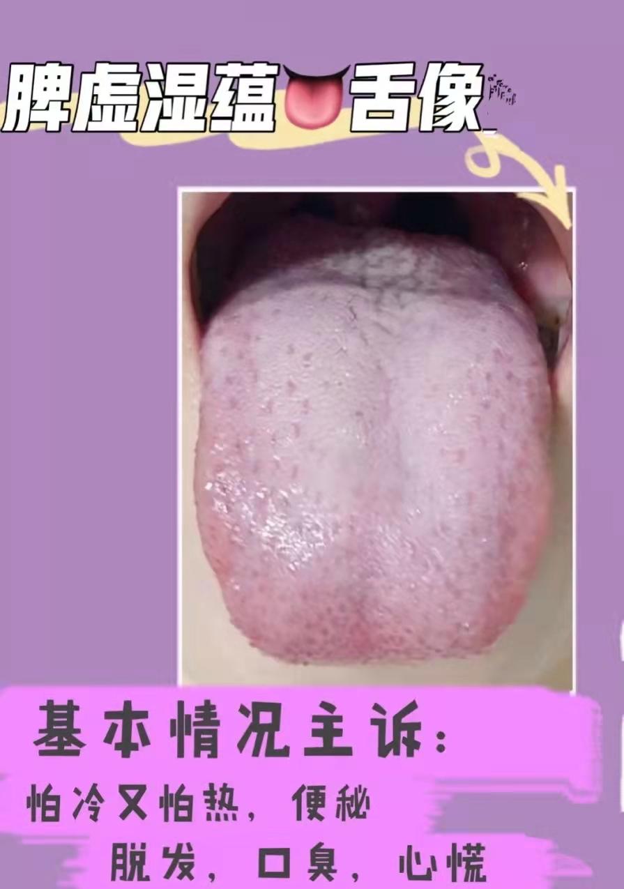 脾胃虚健脾胃的中药,十种健脾胃的中成药该如何调理