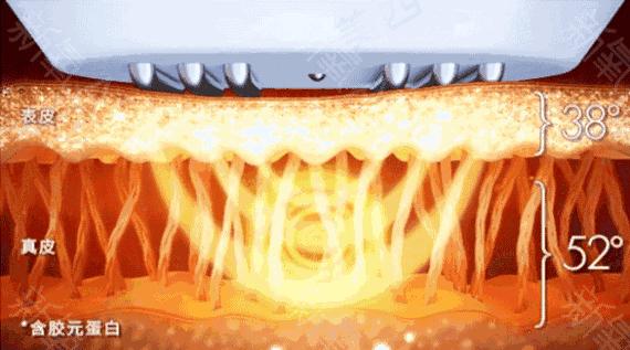 美容黑幕,美容仪内幕大揭秘