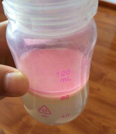 母乳挤出来是绿色可以喂奶吗,哺乳期的母乳正常是什么颜色