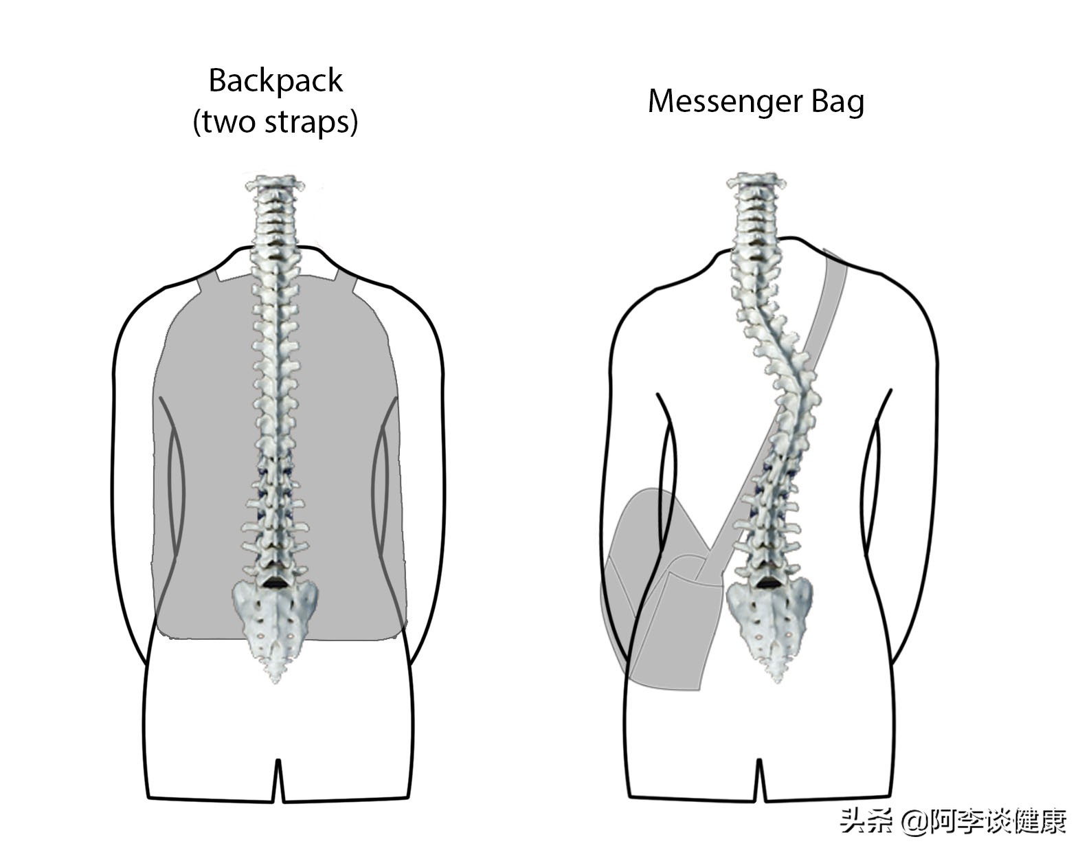 腰酸后背疼颈部不舒服是怎么回事,脊柱痛腰痛怎么办
