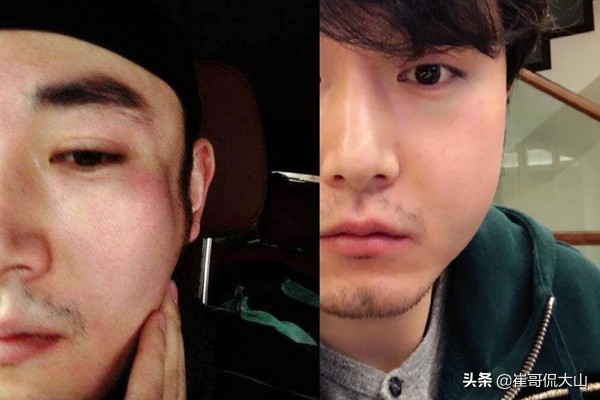 李东学毁容真的吗,李东学受伤是真的吗