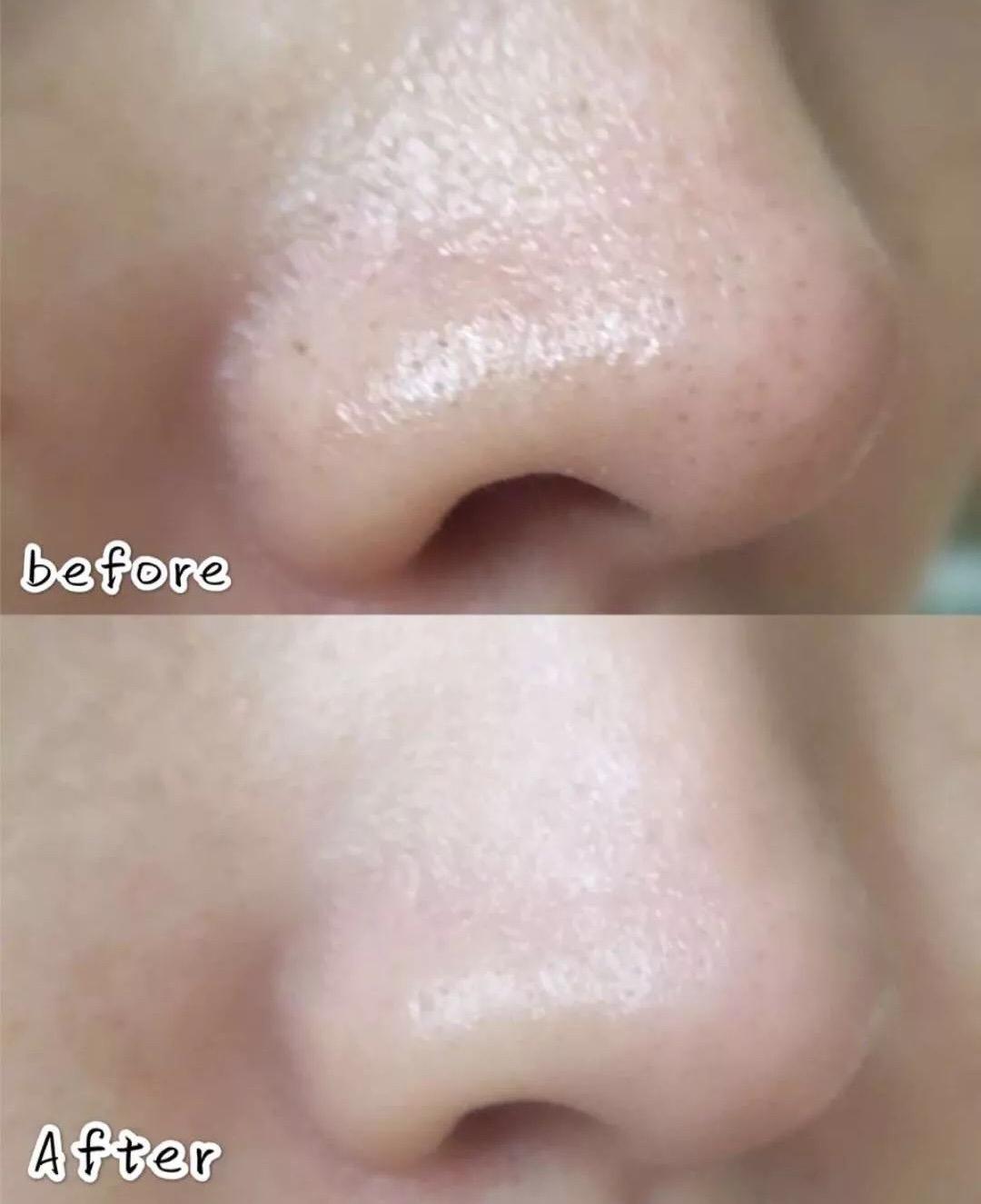 李佳琦推荐去黑头产品真的好用吗,吸黑头神器李佳琦推荐