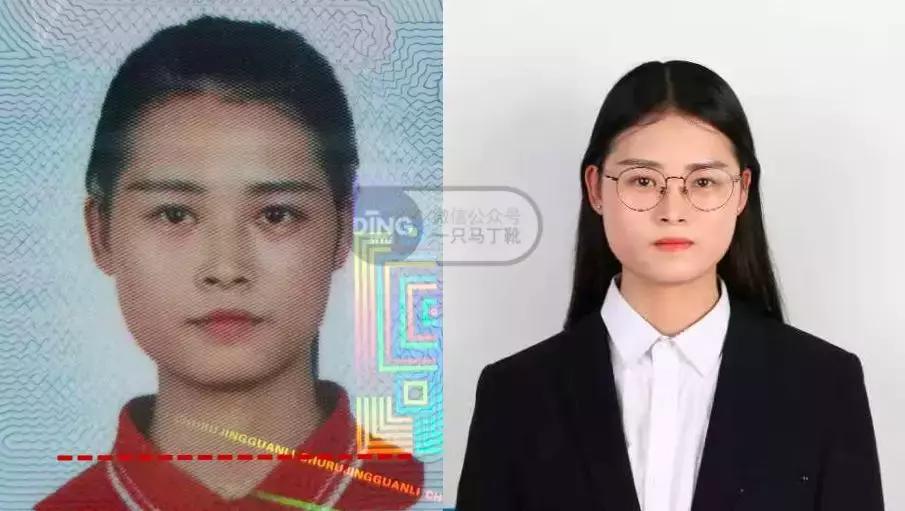 脸大小不对称怎么矫正,如何改善大小脸不对称