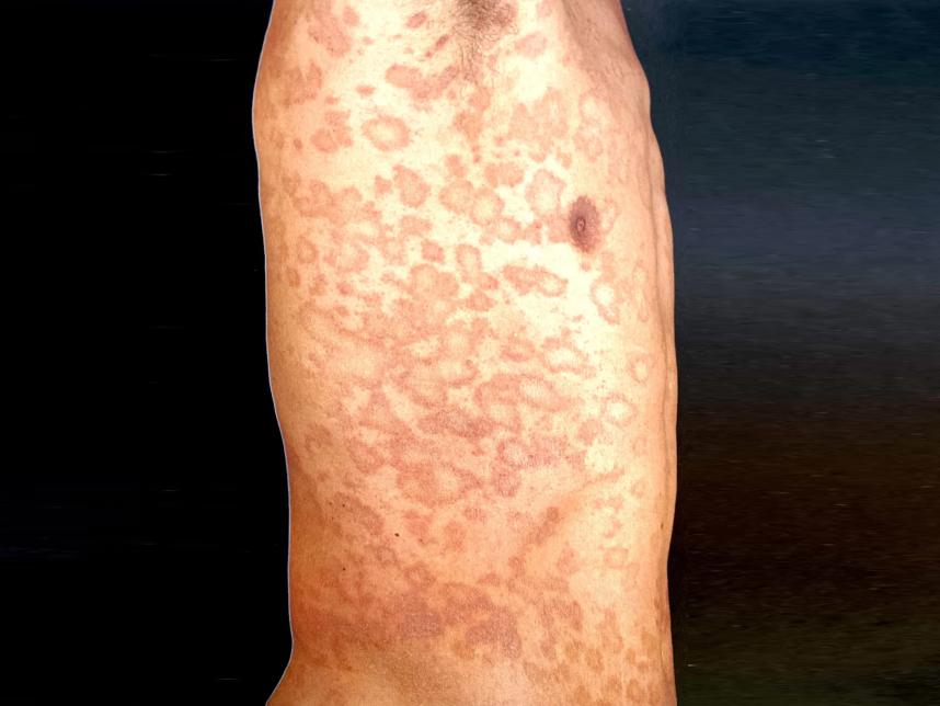 看着身上一片片“玫瑰花瓣”，我把怀疑的目光投向了猫咪