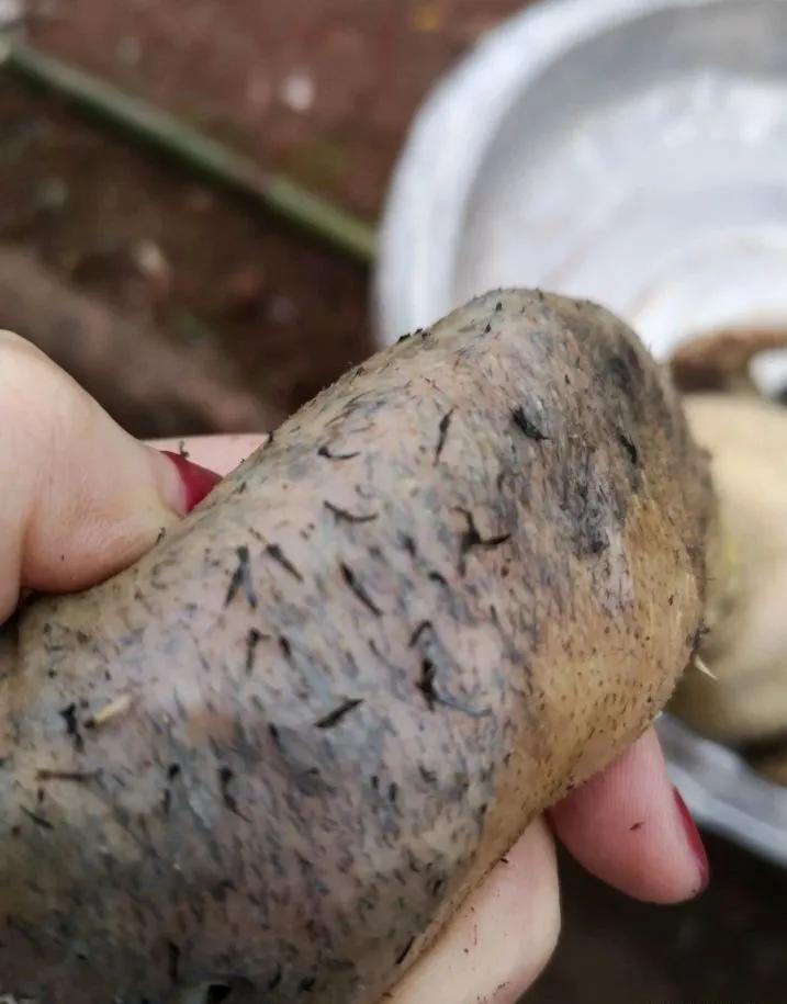 有必要把黑头故意挤出来吗,黑头真能挤出来那么多吗