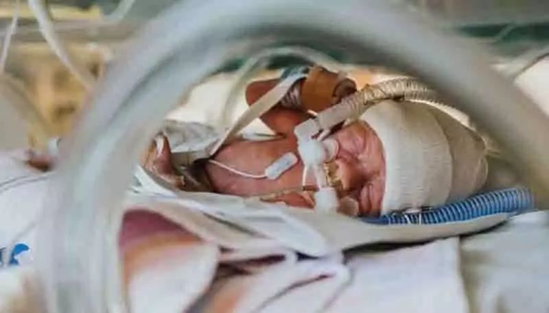 心疼！出生2天早产儿腹胀如包子生命垂危，医生打开腹...